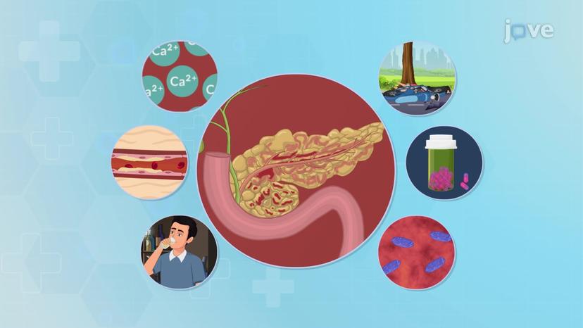 Acute Pancreatitis I: Introduction