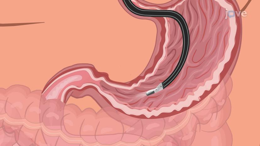 Ultrasound II: Endoscopic Ultrasound and FibroScan