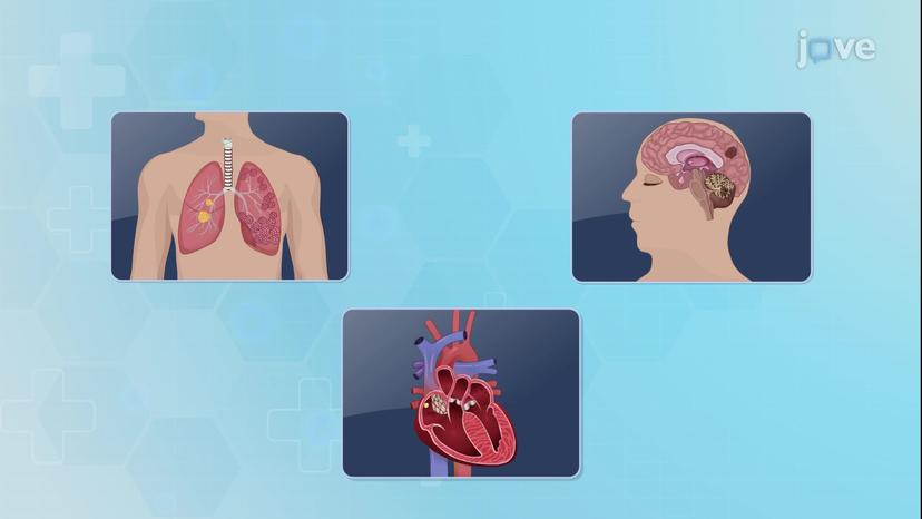 Imaging Studies II: Positron Emission Tomography and Scintigraphy