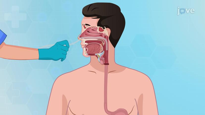 Enteral Nutrition II: Nasointestinal and Gastrostomy Feeding