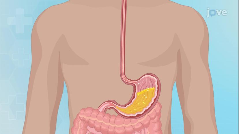 Upper GI Series: Barium Swallow