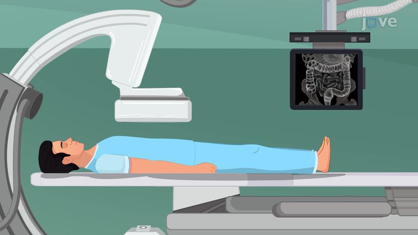 Lower GI Series: Barium Enema