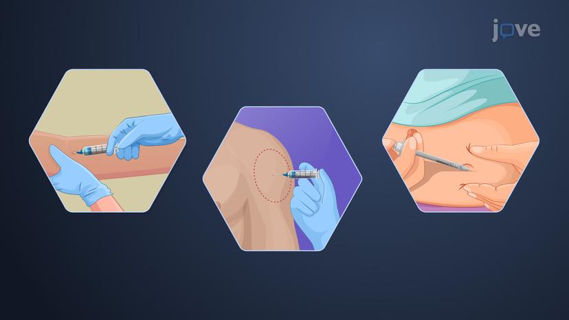 Drug Delivery: Parenteral Route