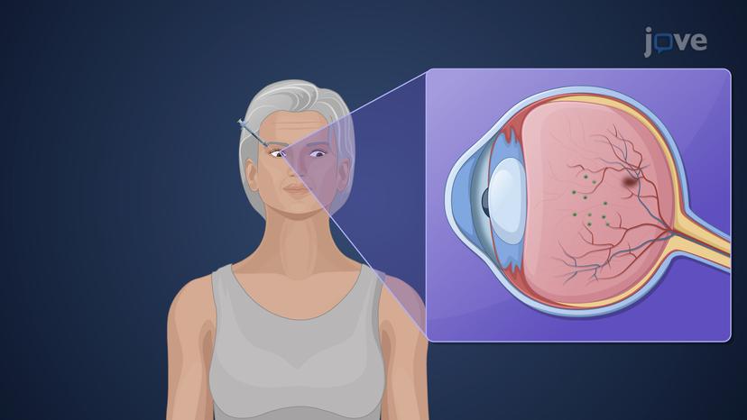 Drug Delivery: Miscellaneous Routes