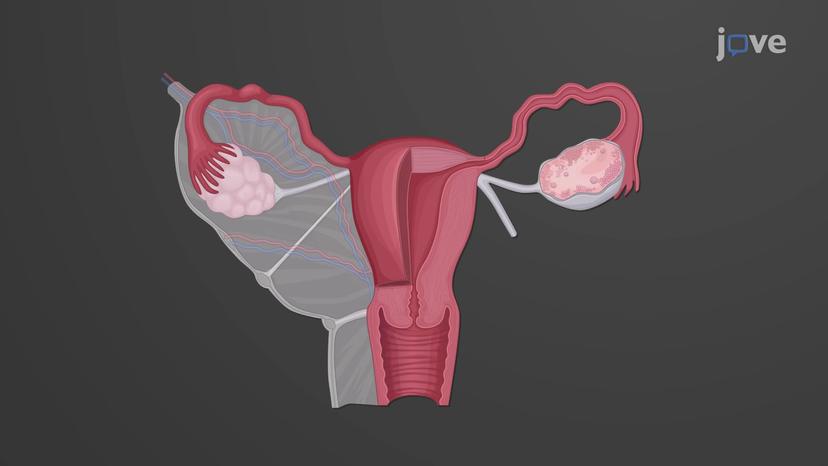 Histology of the Uterus