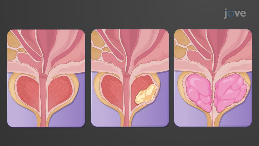 Disorders of the Male Reproductive System