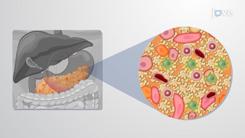 Pathophysiology of Diabetes