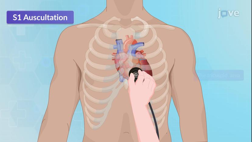 Assessment of the Cardiovascular System IV: Auscultation