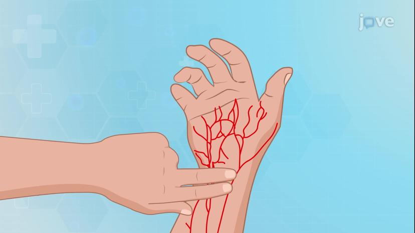 Cardiovascular System Abnormal Findings I: Inspection and Palpation