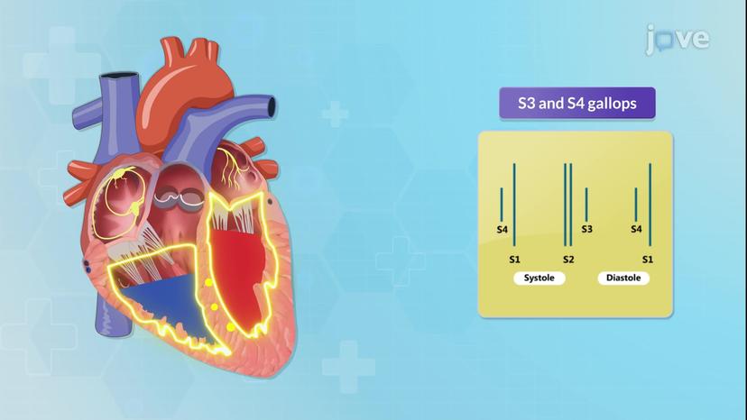 Cardiovascular System Abnormal Findings II: Auscultation