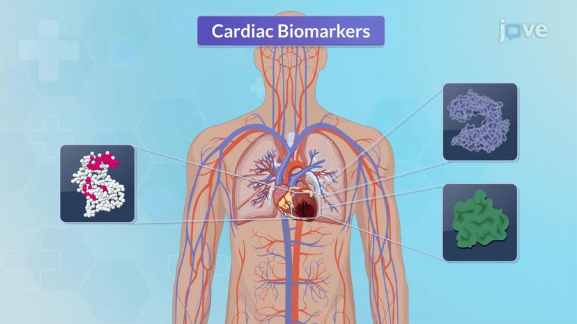 Blood Studies for Cardiovascular System I: Cardiac Biomarkers