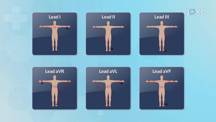 Electrocardiogram Fundamentals