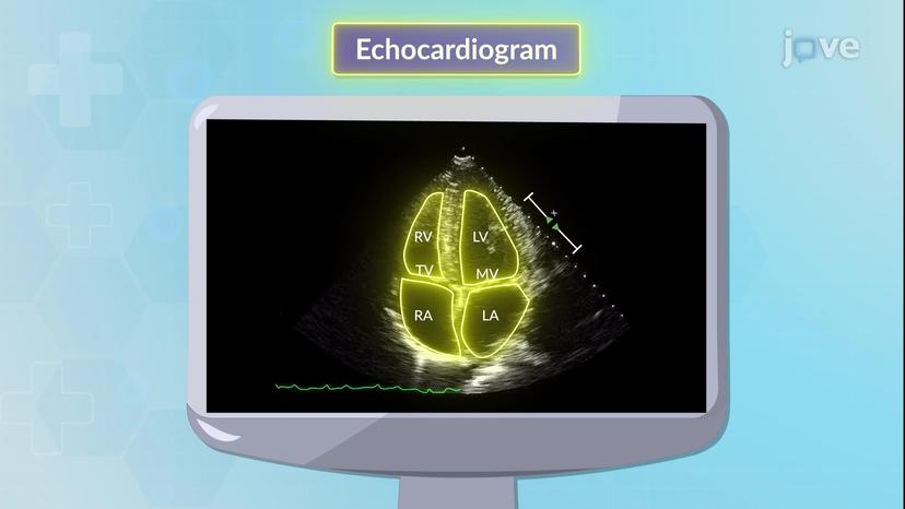 Imaging Studies for Cardiovascular System I:Echocardiography