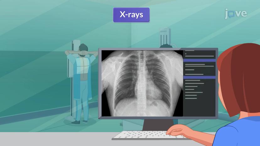 Imaging Studies for Cardiovascular System III: X-Ray