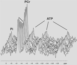 figure-protocol-16838