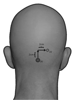 figure-protocol-5862 figure-protocol-5862