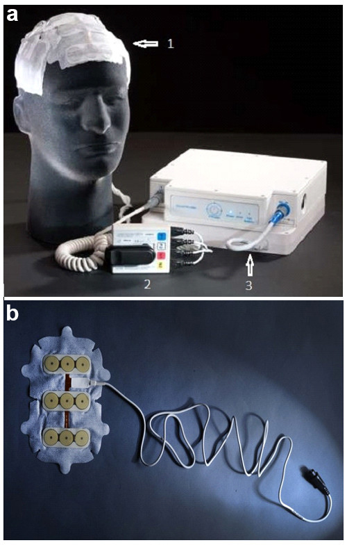 Tumor Treating Fields Application In Human Brain Tumor Models: A Non ...