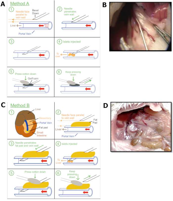 Murine Model of Islet Transplantation: A Surgical Method to Infuse ...