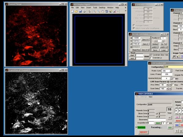 Multi-photon Imaging of Tumor Cell Invasion in an Orthotopic Mouse ...