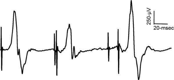 figure-protocol-15642