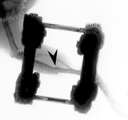 figure-protocol-6630