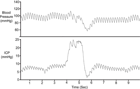 figure-protocol-9732