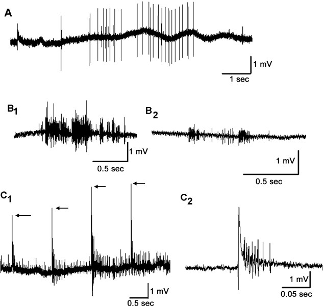 Neural Circuit Recording from an Intact Cockroach Nervous System