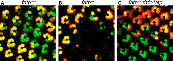 Microscope image showing fatp+/+, fatp-/-, fatp- rh1>fatp expression patterns; fluorescence analysis.