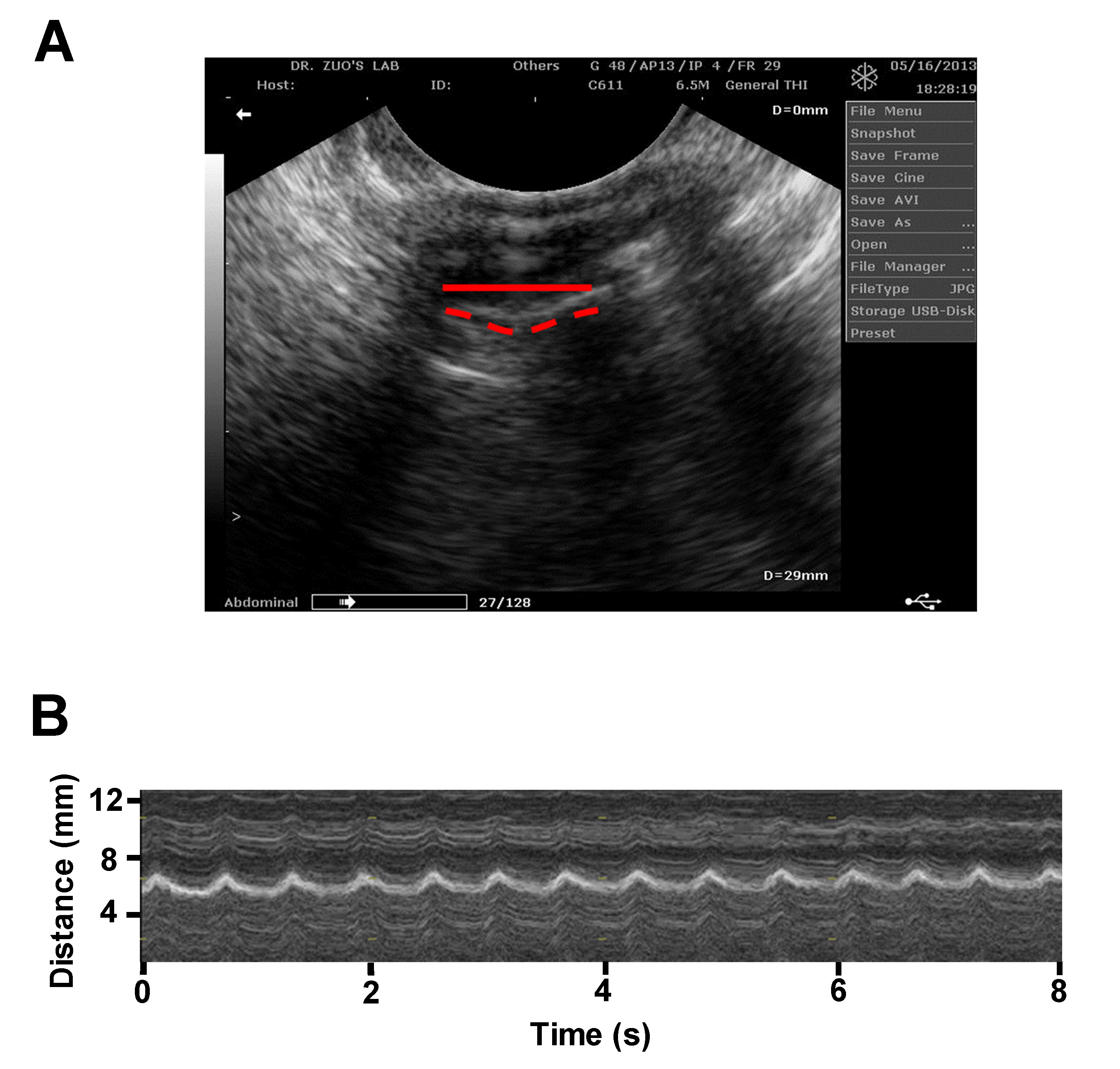 Ultrasound and non-ultrasound imaging techniques in the assessment of  diaphragmatic dysfunction, BMC Pulmonary Medicine