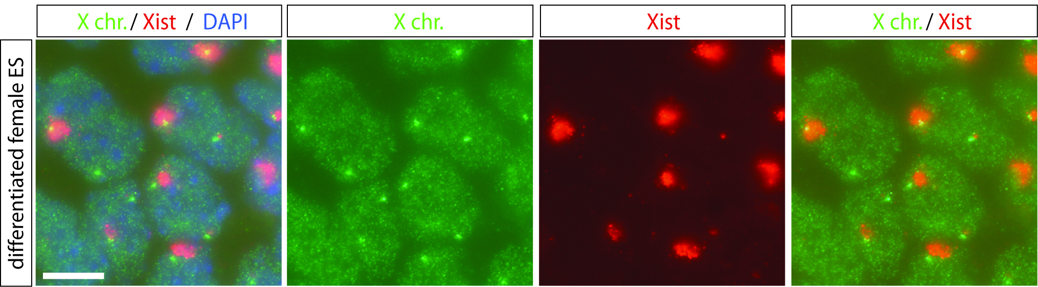 Combined DNA-RNA Fluorescent In situ Hybridization (FISH) to Study X  Chromosome Inactivation in Differentiated Female Mouse Embryonic Stem Cells  (Video) | JoVE