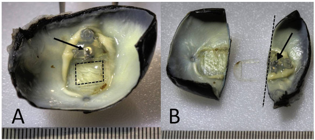 Techniques for Processing Eyes Implanted with a Retinal Prosthesis for ...