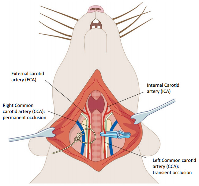 Performing Permanent Distal Middle Cerebral with Common Carotid Artery  Occlusion in Aged Rats to Study Cortical Ischemia with Sustained Disability