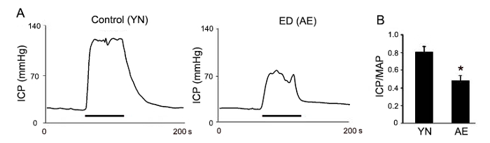 Intracavernosal Pressure Recording to Evaluate Erectile Function