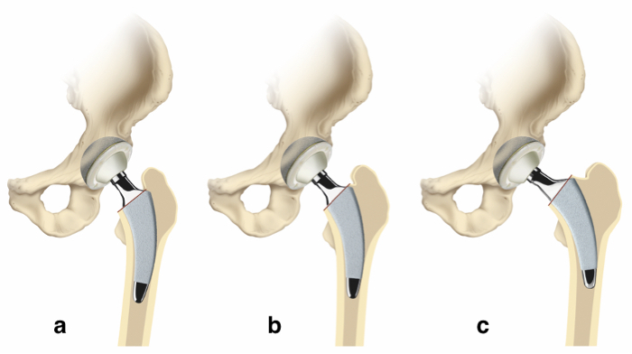 figure-representative results-3646