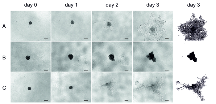 Fully Human Tumor-based Matrix in Three-dimensional Spheroid Invasion Assay