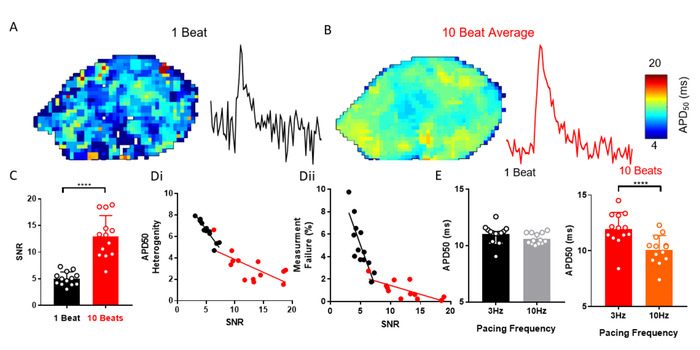Electrophysiology signal analysis diagrams; APD50 heat maps, SNR vs APD50 frequency graphs.