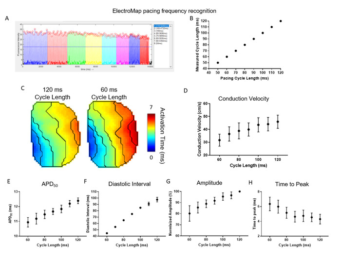 ElectroMap pacing frequency recognition; graphs, activation maps, conduction velocity analysis.