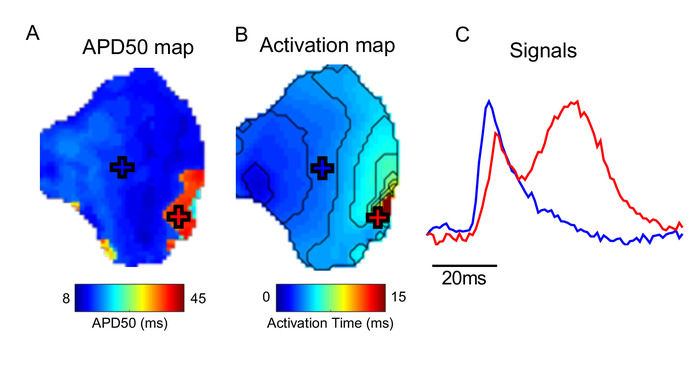Cardiac electrophysiology maps showing APD50 and activation with time signals.