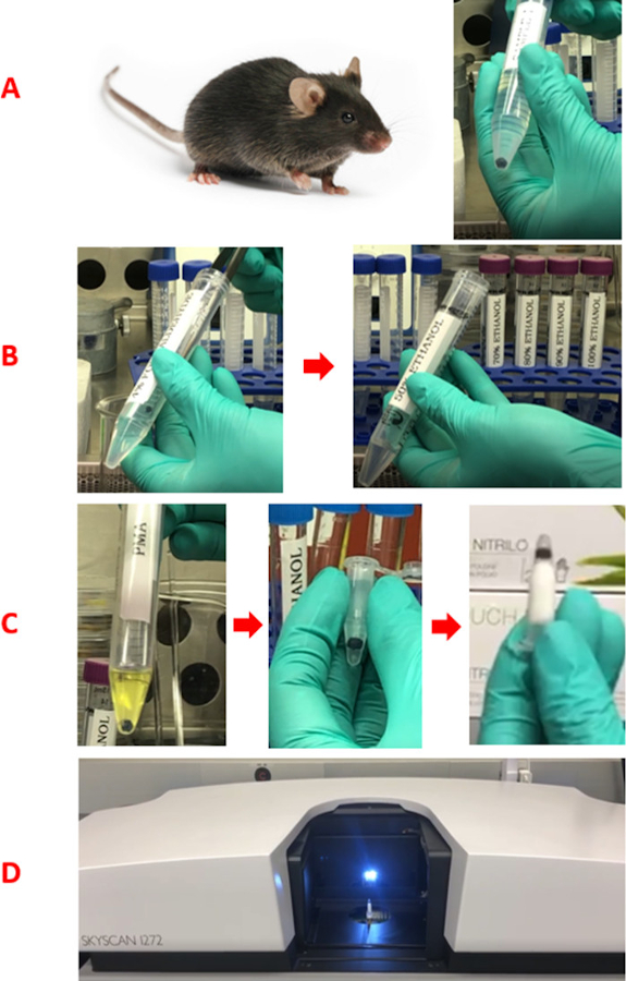 Assessment of Global Ocular Structure Following Spaceflight Using a ...