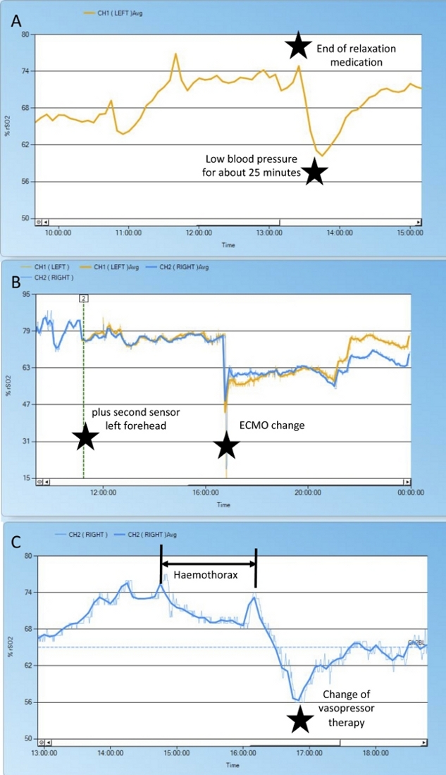 figure-representative results-10910