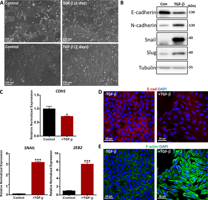 TGF-β induced epithelial-mesenchymal transition; microscopy, Western blot, gene expression analysis.