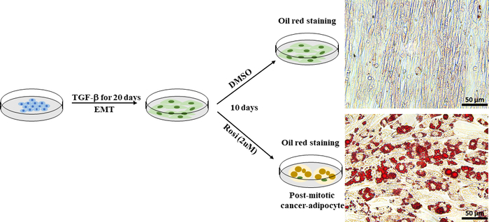 EMT process diagram, oil red staining, post-mitotic cancer-adipocyte microscopy, TGF-β experiment.