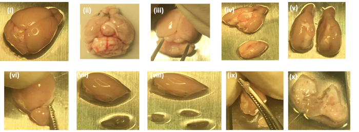 Microdissection of Mouse Brain into Functionally and Anatomically Different  Regions