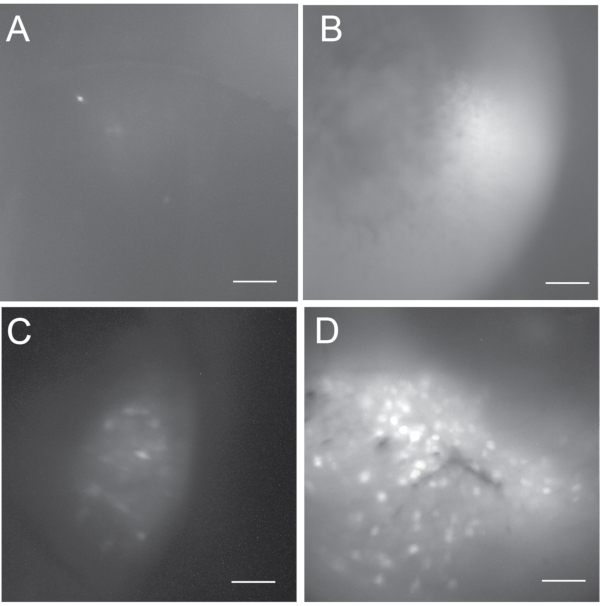 Using Baseplating and a Miniscope Preanchored with an Objective Lens for  Calcium Transient Research in Mice