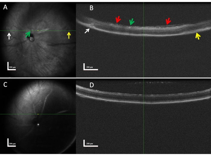 Optical Coherence Tomography: Imaging Mouse Retinal Ganglion Cells