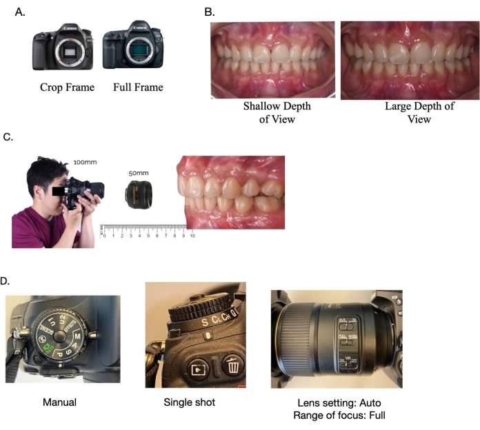 Double miroir de photographie dentaire, orthodontie, réflecteur