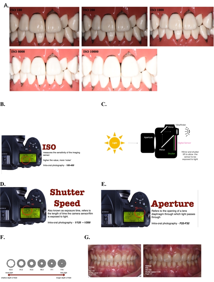 Photography for Dentists: How to get started | Avant Dental
