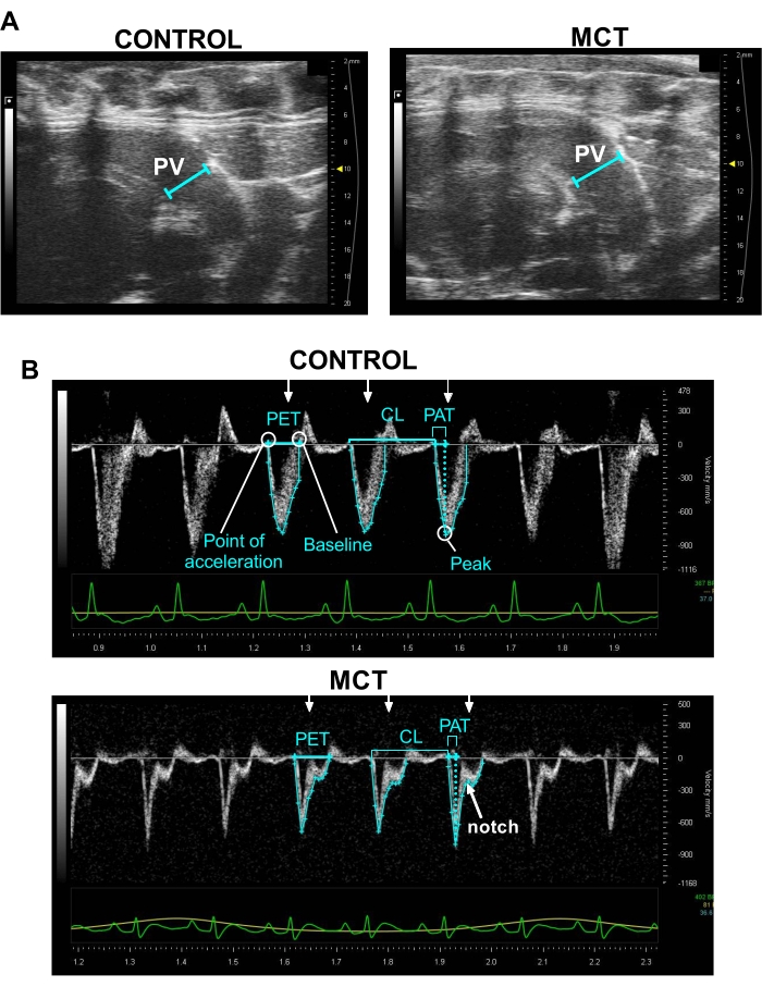 Comprehensive Echocardiographic Assessment of Right Ventricle Function in a  Rat Model of Pulmonary Arterial Hypertension