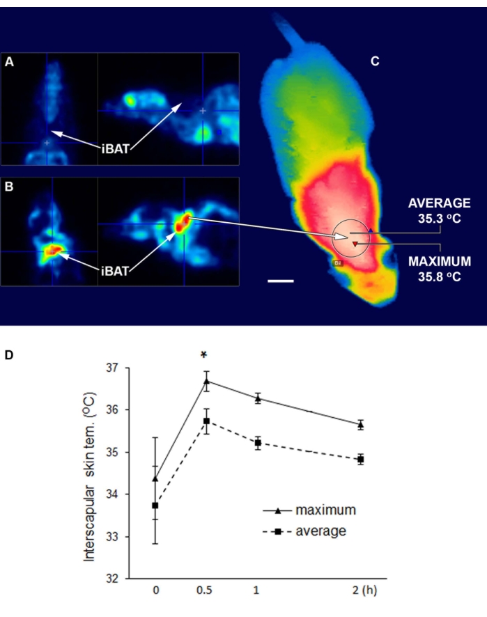 Associations of brown adipose tissue (BAT) 18 F-FDG activity after a