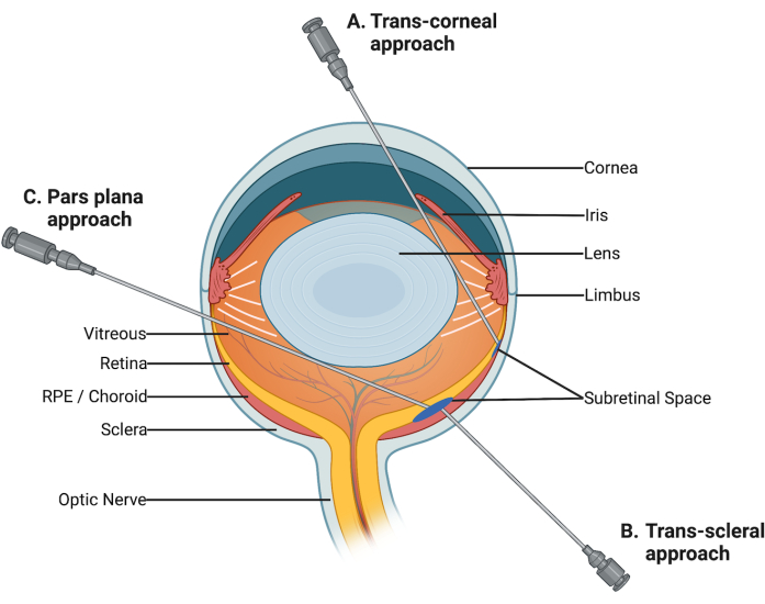 Advancing Vision Restoration â€” Stem Cell-Based Therapy for Retinal  Diseases (Video) | JoVE